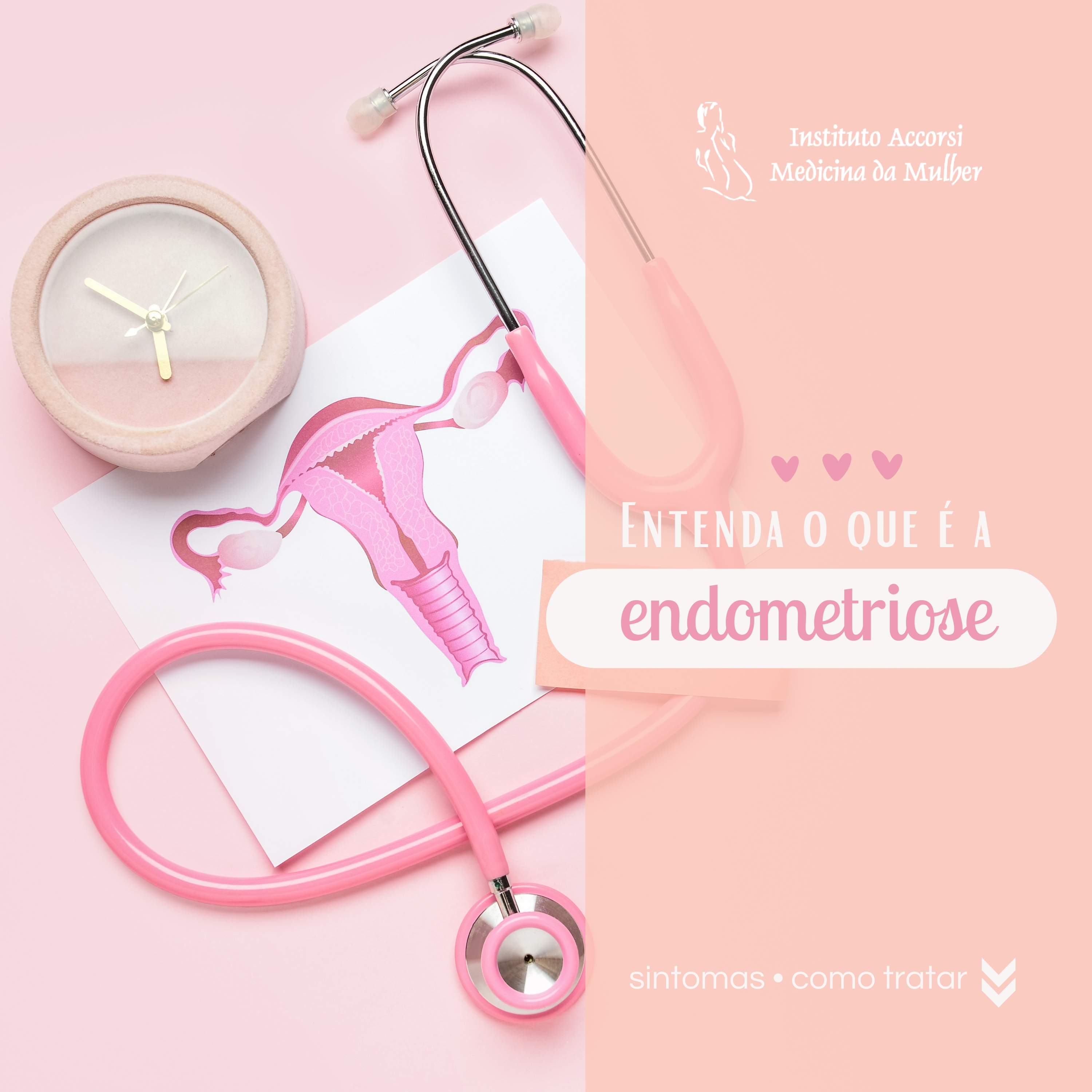 Entenda o que é a Endometriose